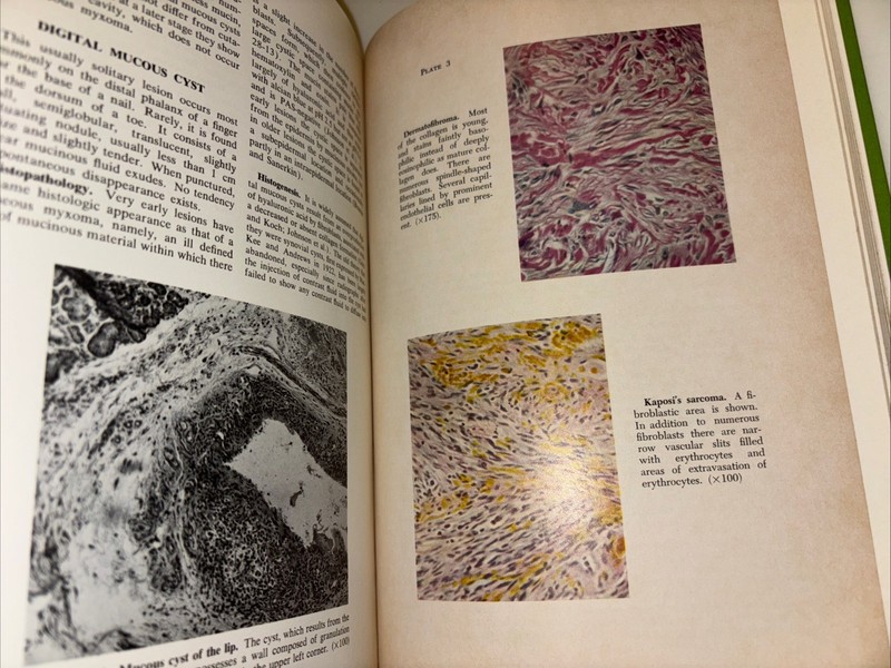 HISTOPATHOLOGY Of The Skin-HC-1975-Walter Lever gallery