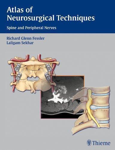 Atlas of Neurosurgical Techniques: Spine and Peripheral Nerves, , 9780865779877