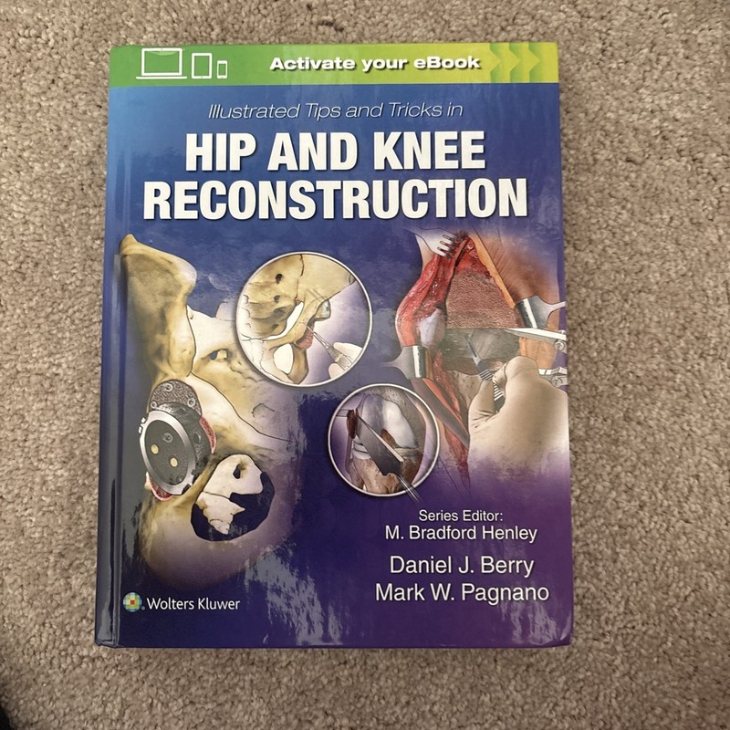 Illustrated Tips and Tricks in Hip and Knee Reconstructive and Replacement Surge
