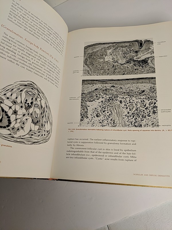 Histologic Diagnosis of Inflammatory Skin Diseases: A Method by Pattern Analysis gallery