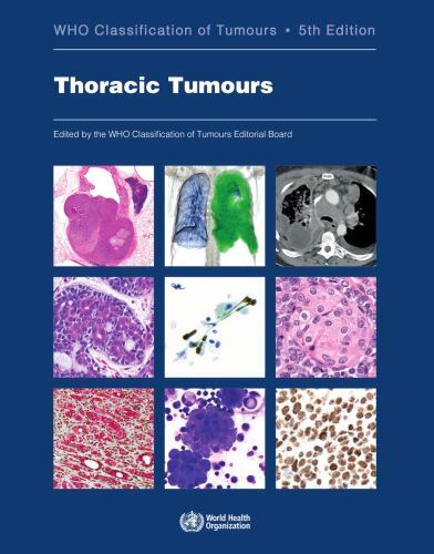 Thoracic Tumours, Paperback by Who Classification of Tumours Editorial Board ...