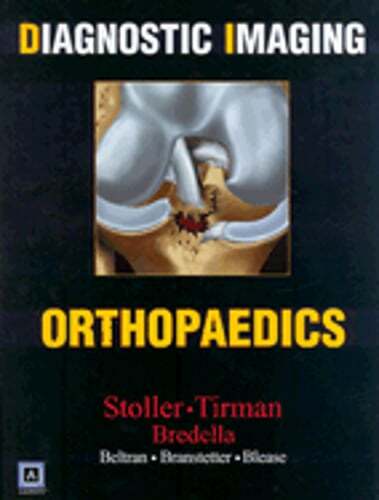 Diagnostic Imaging: Orthopaedics by Facr Stoller, David W, MD: Used
