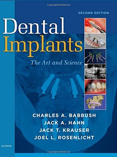 DENTAL IMPLANTS: THE ART AND SCIENCE By Babbush Dds Charles A. Mscd & Hahn Jack